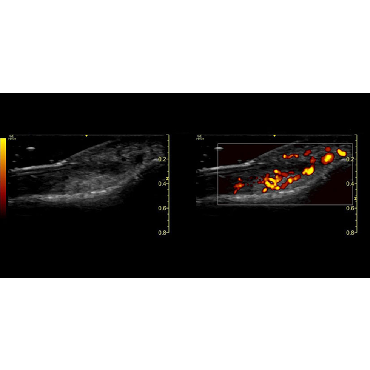 ultrasound image of a nail bed using the L10-22-RS ultrasound transducer